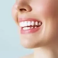 Teeth Whitening - Overland Park - Kansas City